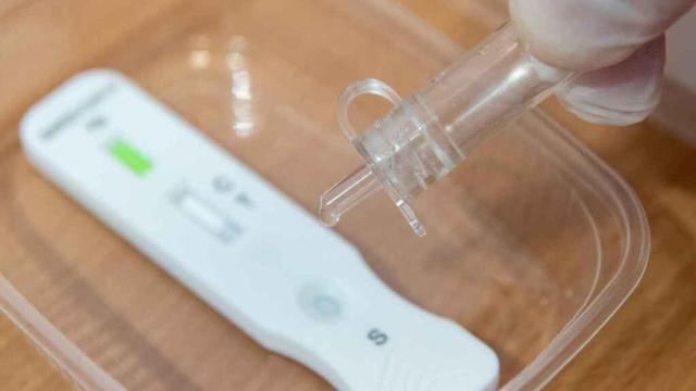 Imagen de una prueba con test de antígenos.