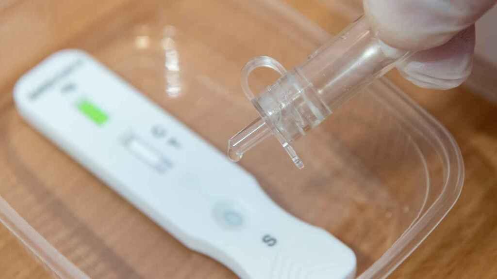 Imagen de una prueba con test de antígenos.
