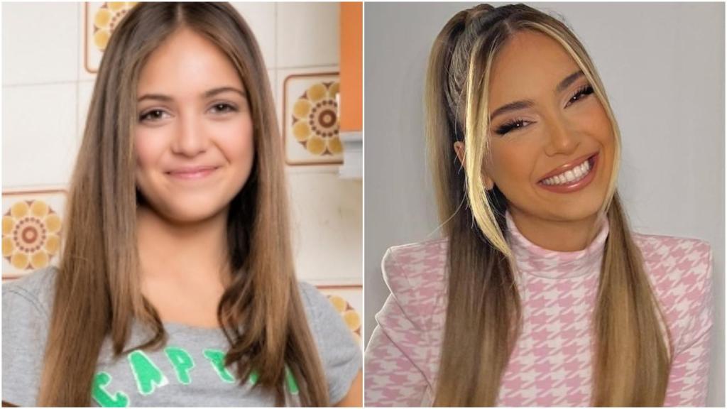 Ana Mena podría haberse infiltrado los labios para darte más hidratación y grosor.