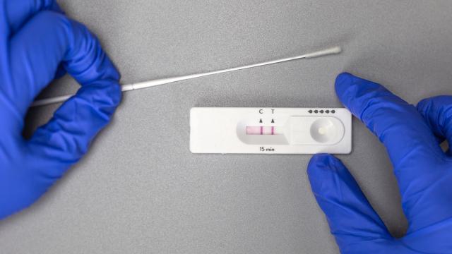 Test de antígenos de autodiagnóstico positivo en Covid-19.