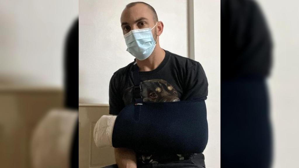 José 'El Mechas', con la escayola que le han puesto tras recibir el alta en Madrid.