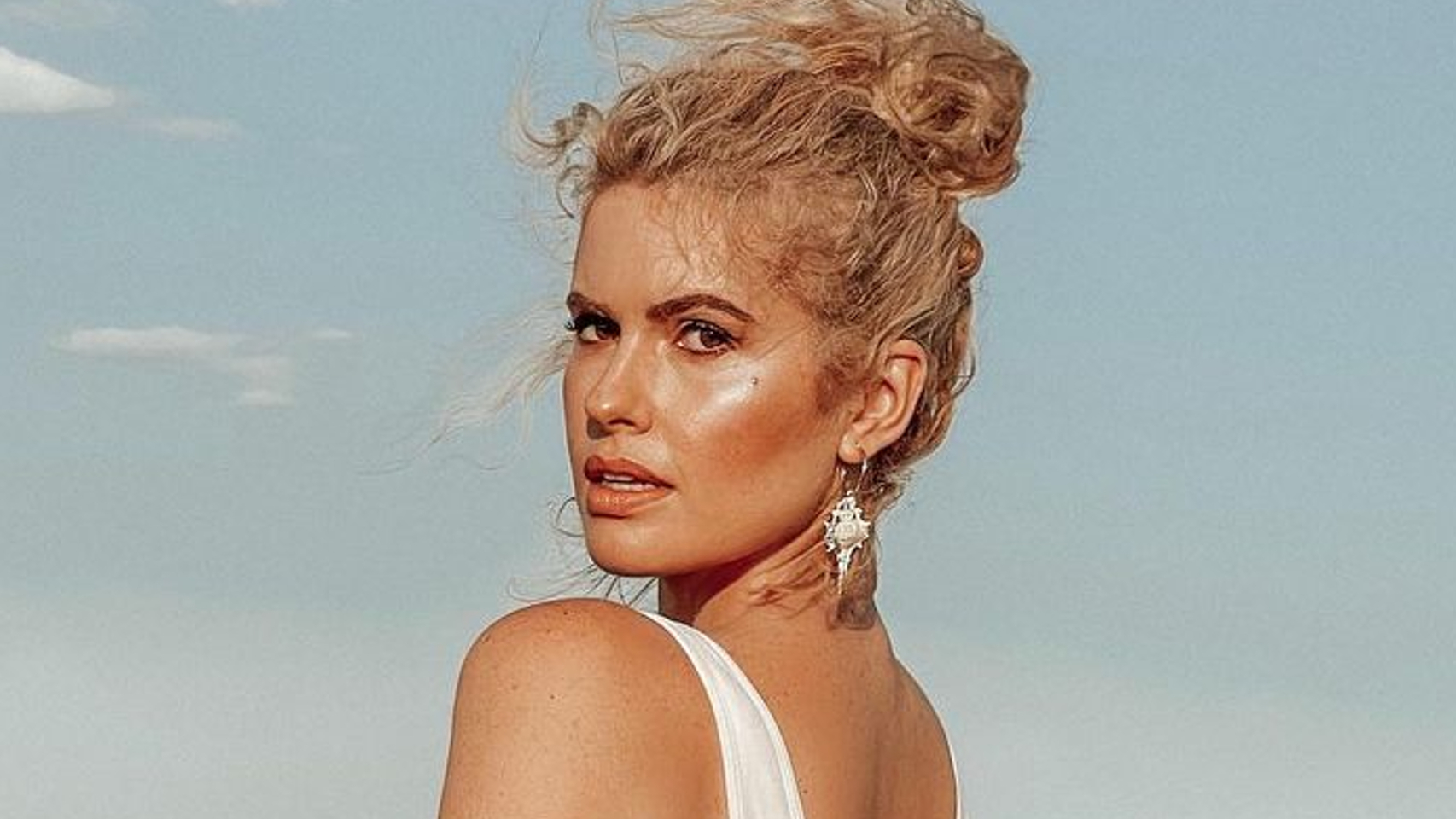 Imágenes del día: Adriana Abenia se desnuda para intentar solucionar su glúteo malherido