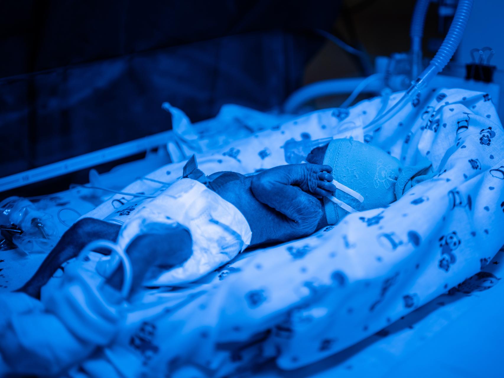 Un bebe de 24 semanas duerme en la Unidad de Cuidados Intensivos del Hospital regional materno de Odesa.