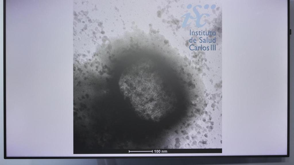 Una molécula de la viruela del mono como resultado de un estudio