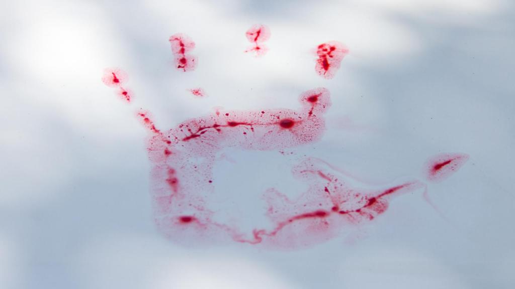 Pillados dos ladrones tras dejar como pista su sangre tras llevarse la batería de un coche en Alicante