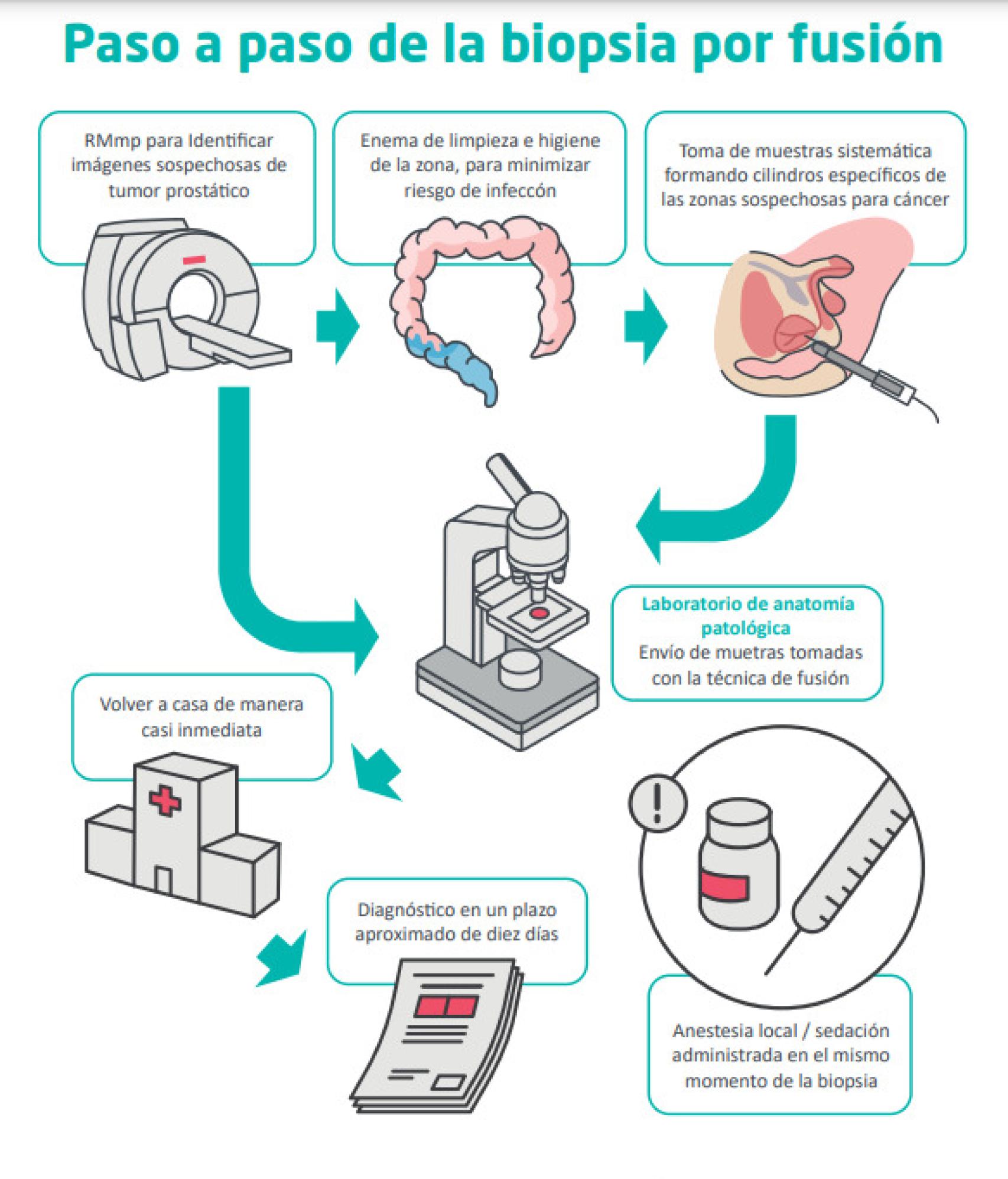 Cartel explicativo de la técnica de biopsia fusión.