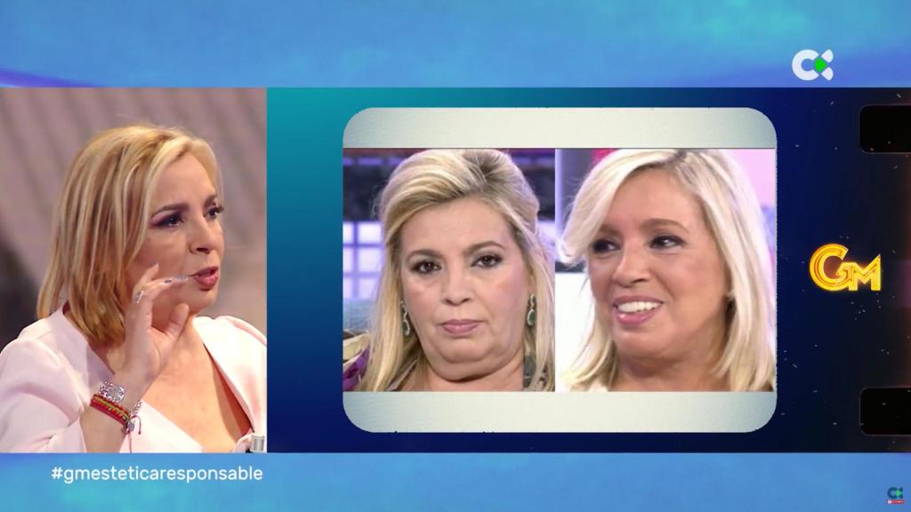 Carmen Borrego: Ahora soy más feliz gracias a la cirugía estética y al psicólogo