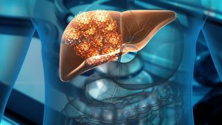 Investigadores salmantinos participan en un hallazgo histórico contra un cáncer de hígado letal