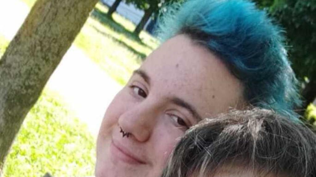 Nori afirma haber dejado ya atrás las autolesiones.