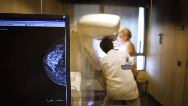 Una mujer se somete a una mamografía.