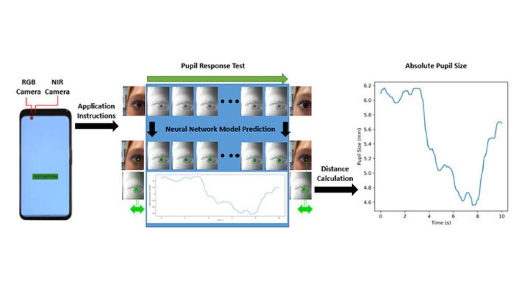 Diagrama de la lectura de la pupila