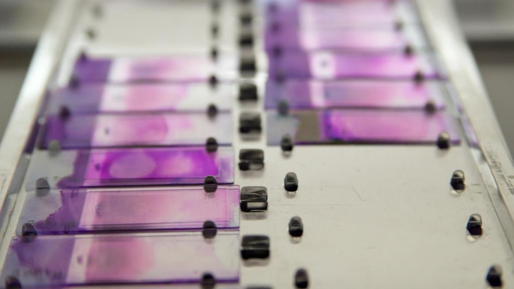 Muestras de un laboratorio.