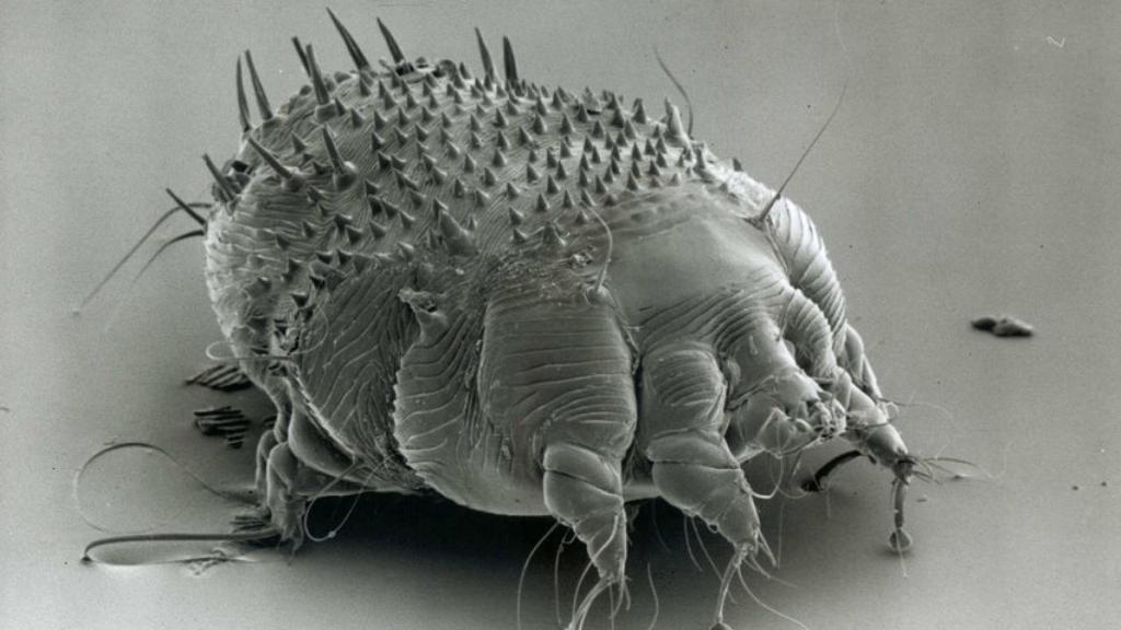 El ácaro que provoca la sarna en humanos, el 'sarcoptes scabiei'.