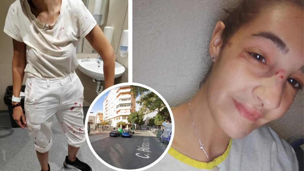 Imágenes de Laura, atropellada.