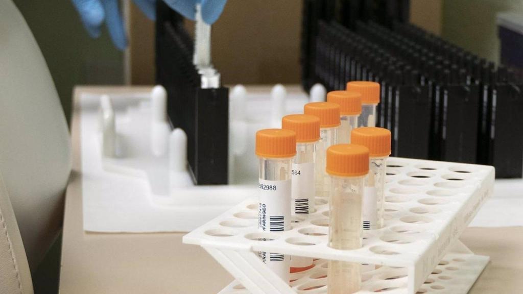 Casos de viruela del mono.