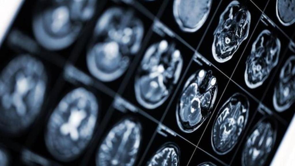 Un escáner cerebral.