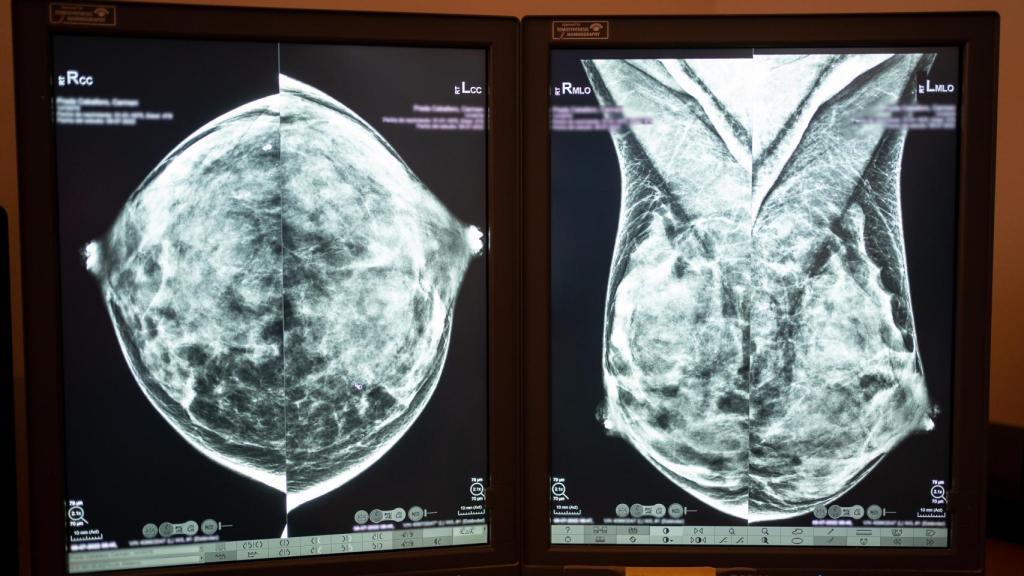 Una prueba de imagen de una mama.