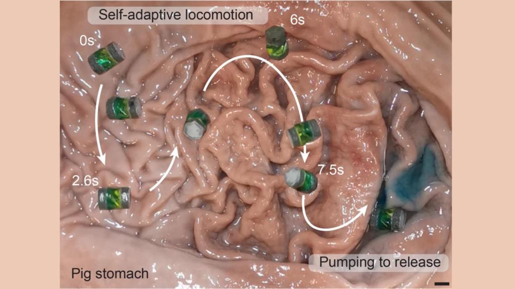 Los microrobots en acción en el estómago de un cerdo.