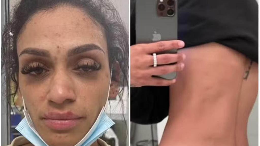 Las imágenes de la mujer de Miles Bridges tras la agresión.