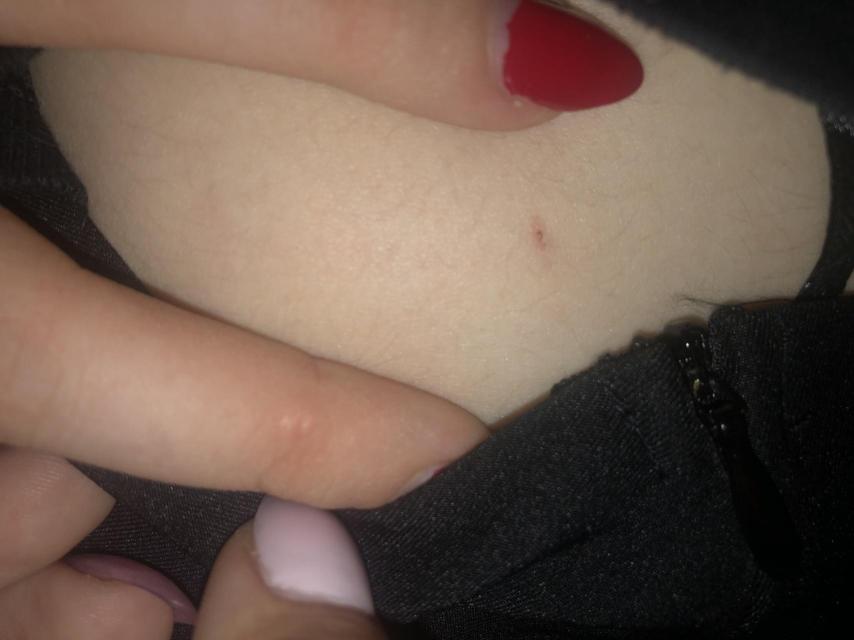 Imagen de archivo de un posible caso de sumisión química mediante el pinchazo.