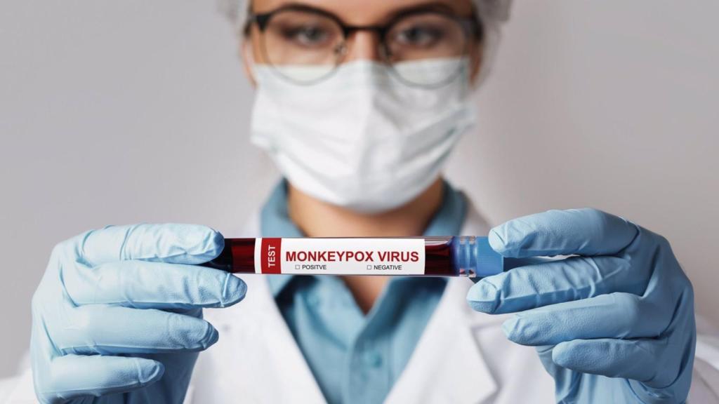 Seis casos más de viruela del mono elevan los positivos en Castilla-La Mancha a 44