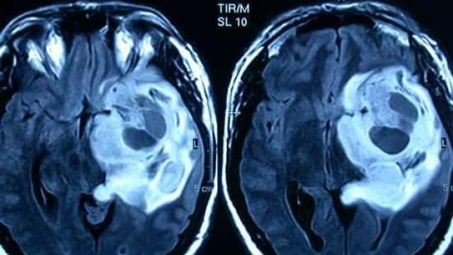 Imagen de un escáner cerebral.