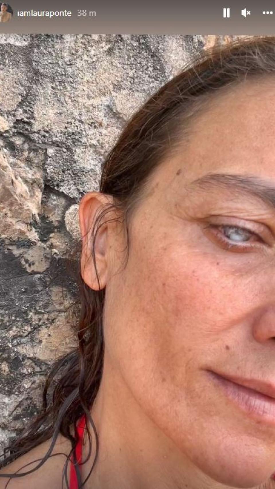 La modelo Laura Ponte enseña en redes sociales su ojo operado.