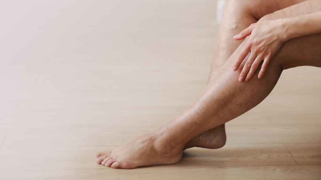 Imagen de archivo de una mujer con problemas de circulación.