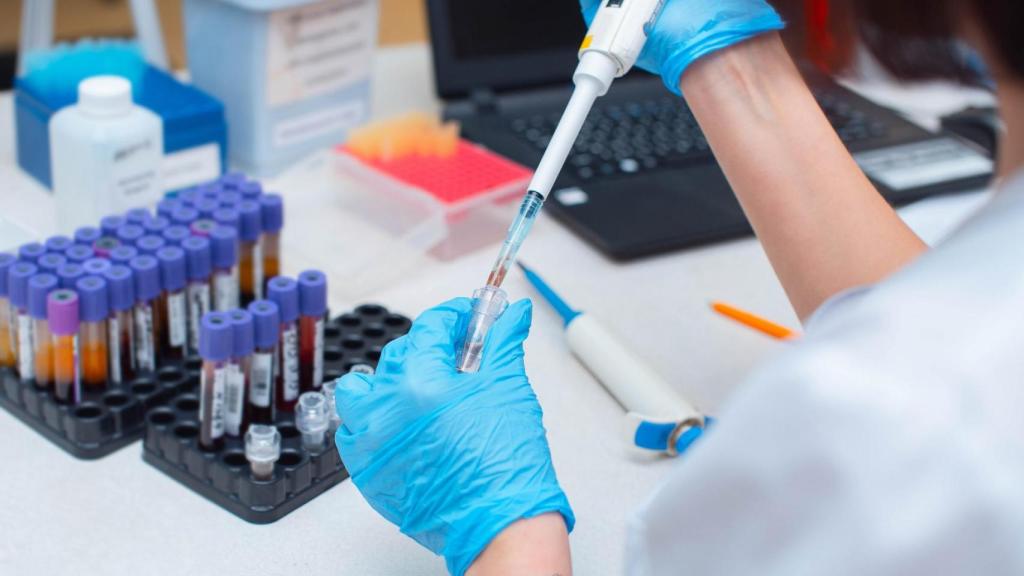 Investigación sobre VIH.