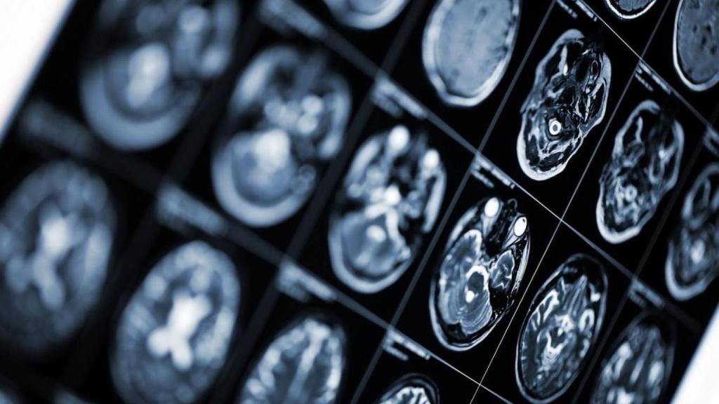 Prueba de imagen del cerebro de un paciente.