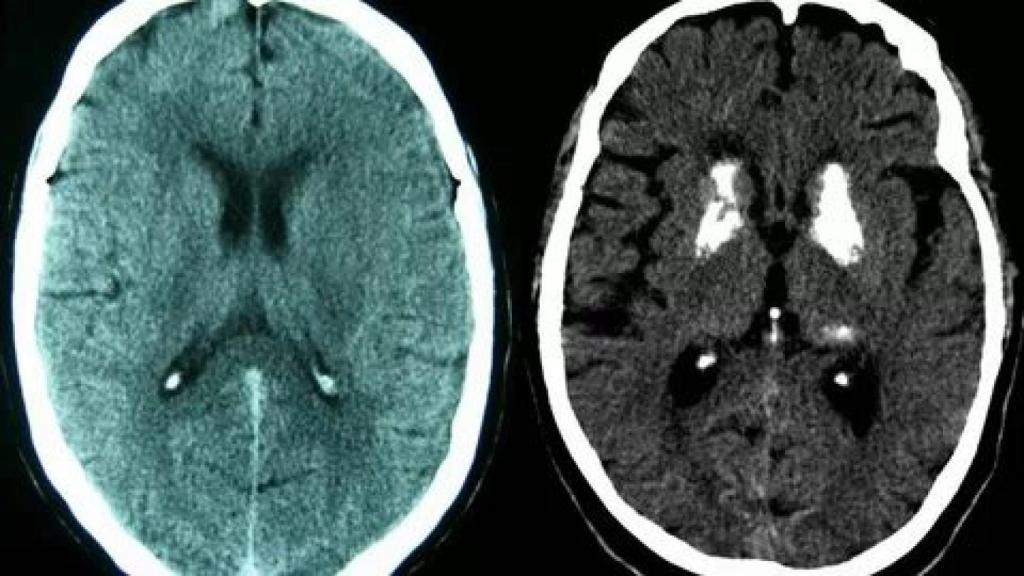 Un escáner cerebral.