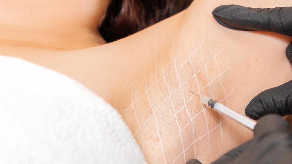 Imagen de Botox en axilas