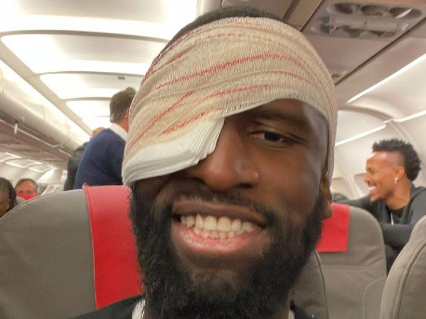 Rüdiger, con el vendaje tras recibir 20 puntos de sutura en la frent