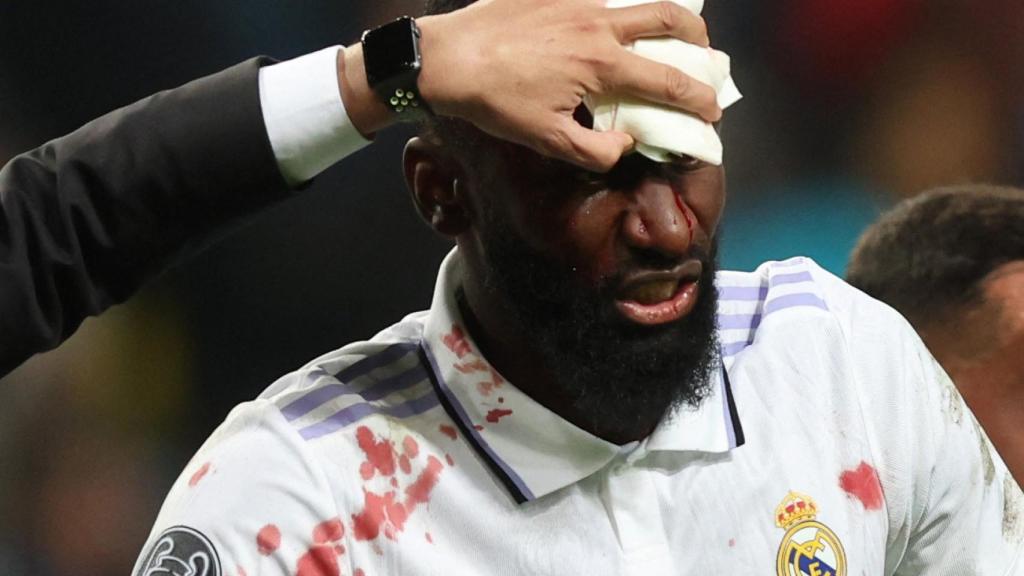 Antonio Rüdiger, con la cara ensangrentada