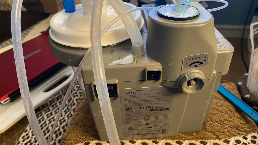 Uno de los aparatos de respiración de Jesús Pineda