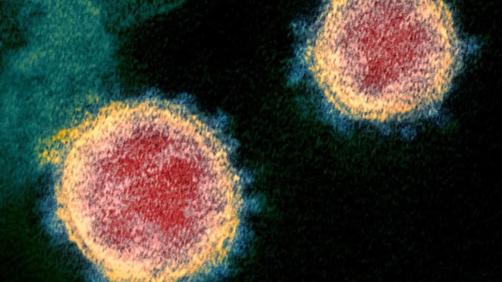 Imagen al microscopio del virus SARS-CoV-2.