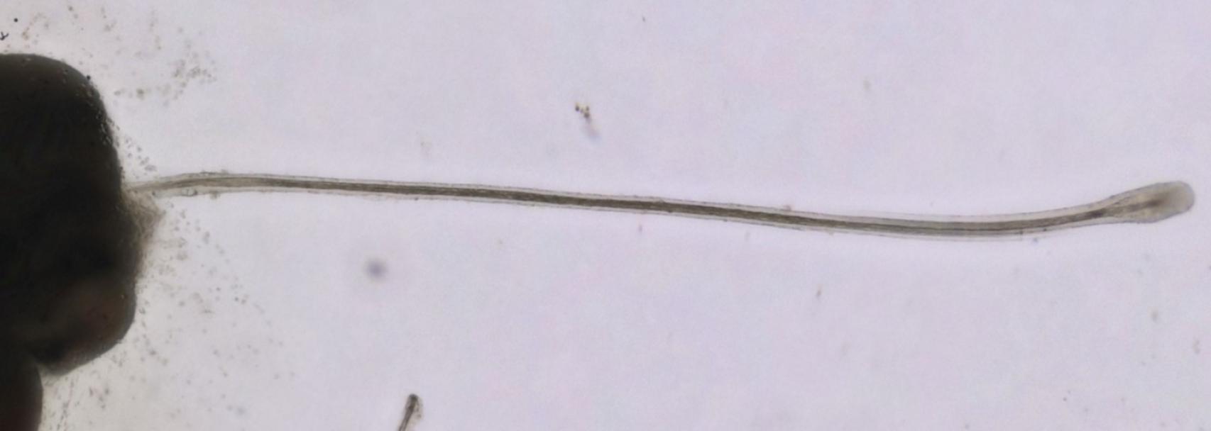 Uno de los cabellos cultivados en laboratorio.