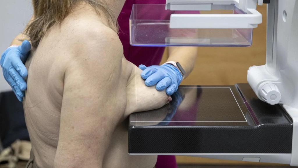 Prueba para detectar el cáncer de mama, en imagen de archivo.