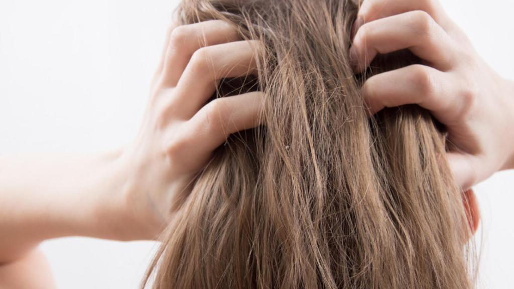 Esta condición dermatológica se caracterizada por la erupción de manchas rojas, irritación y descamación.