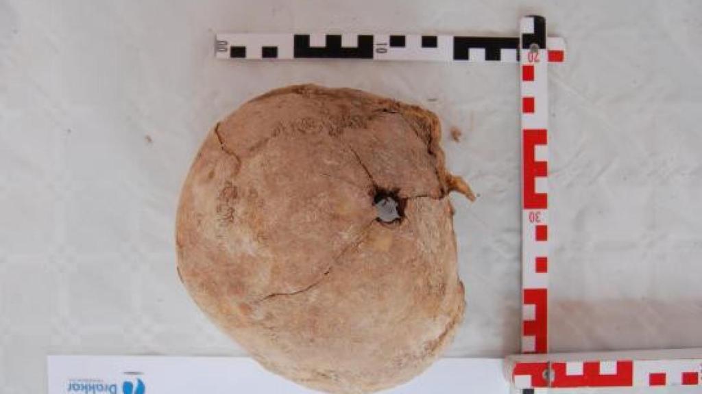 Uno de los cuerpos hallados con un orificio de bala en la cabeza.