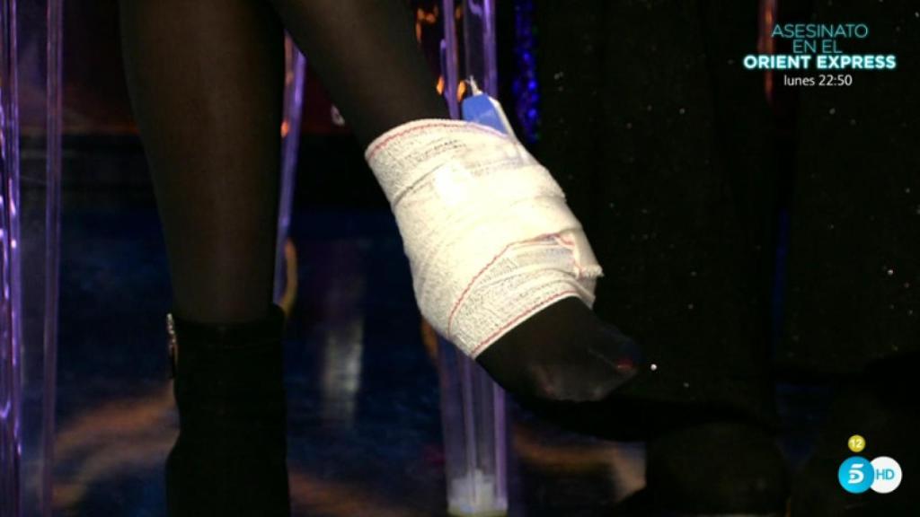 El tobillo de Lydia Lozano.