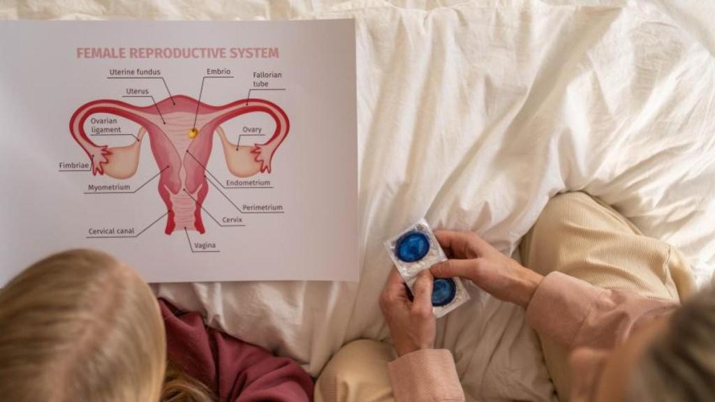 Fotografía de archivo de cáncer de cérvix.