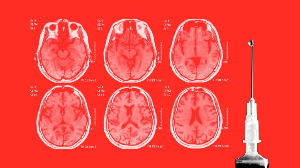La esperanza del diagnóstico precoz del alzhéimer da un paso adelante con este hallazgo.