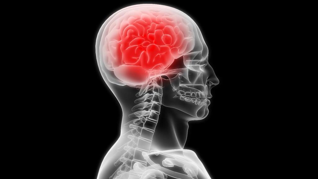 Inflamación del cerebro.