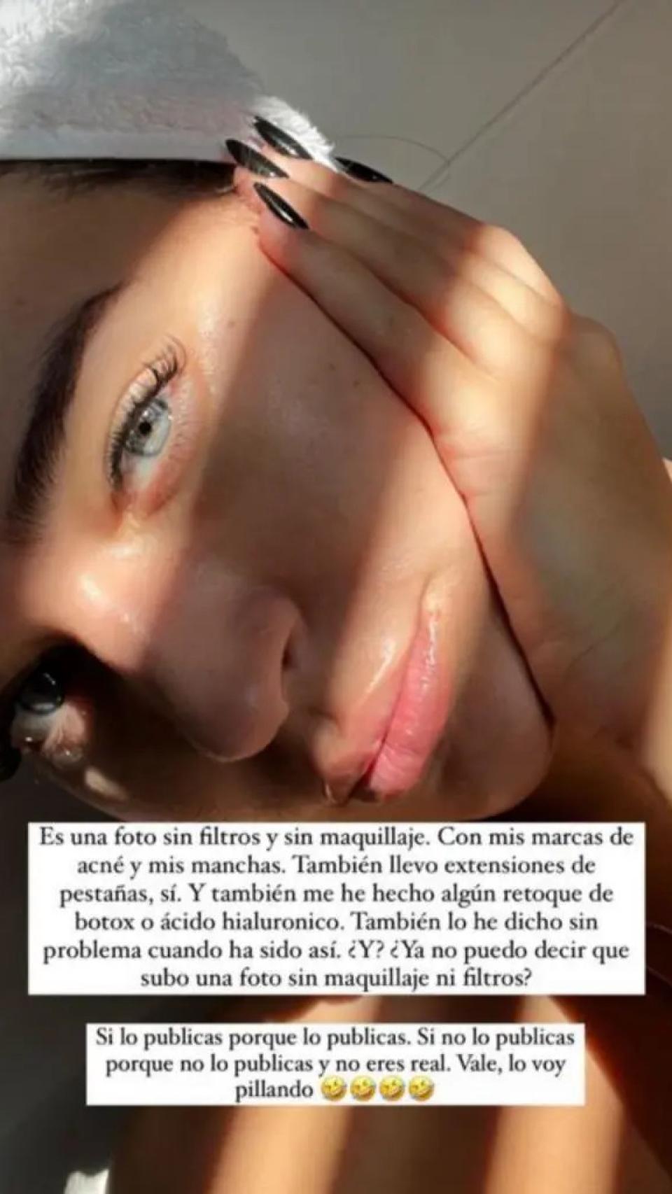 Laura Escanes nunca ha ocultado sus retoques.