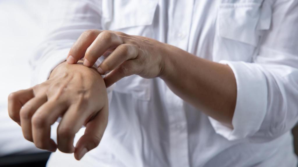 Repunte de un viejo conocido: La Sarna