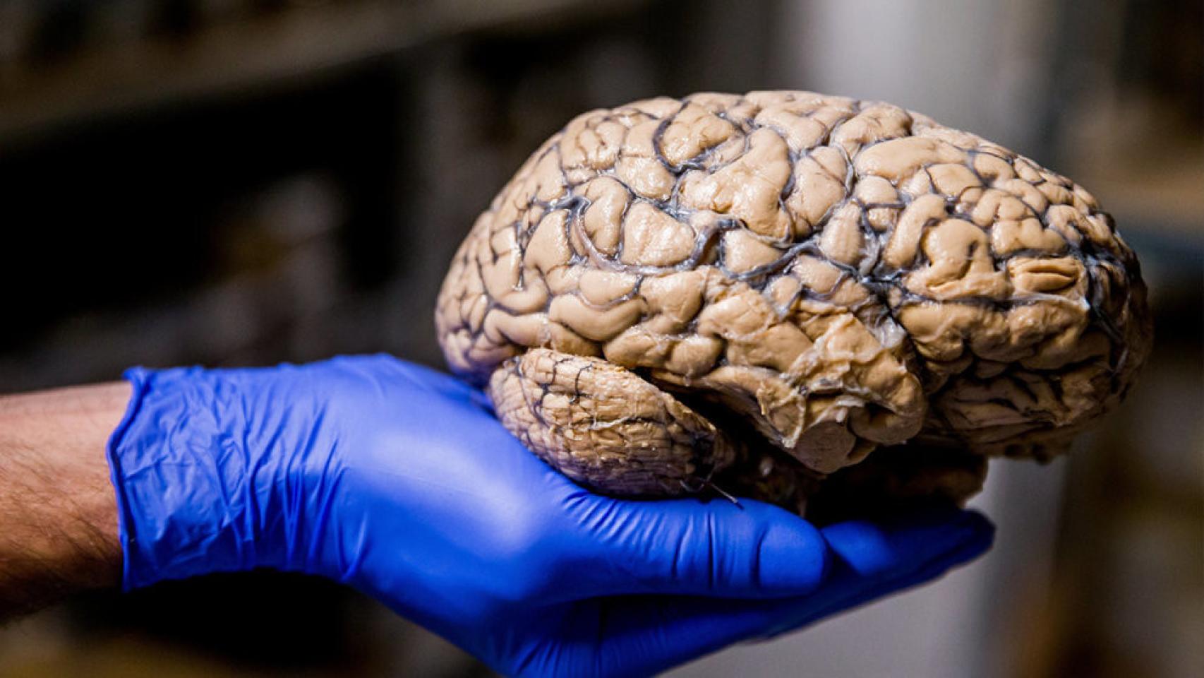 Diversos estudios apoyan que la incidencia del alzhéimer está bajando.