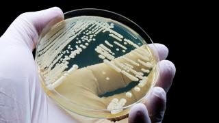 Una cepa de Candida auris cultivada en una placa de Petri.