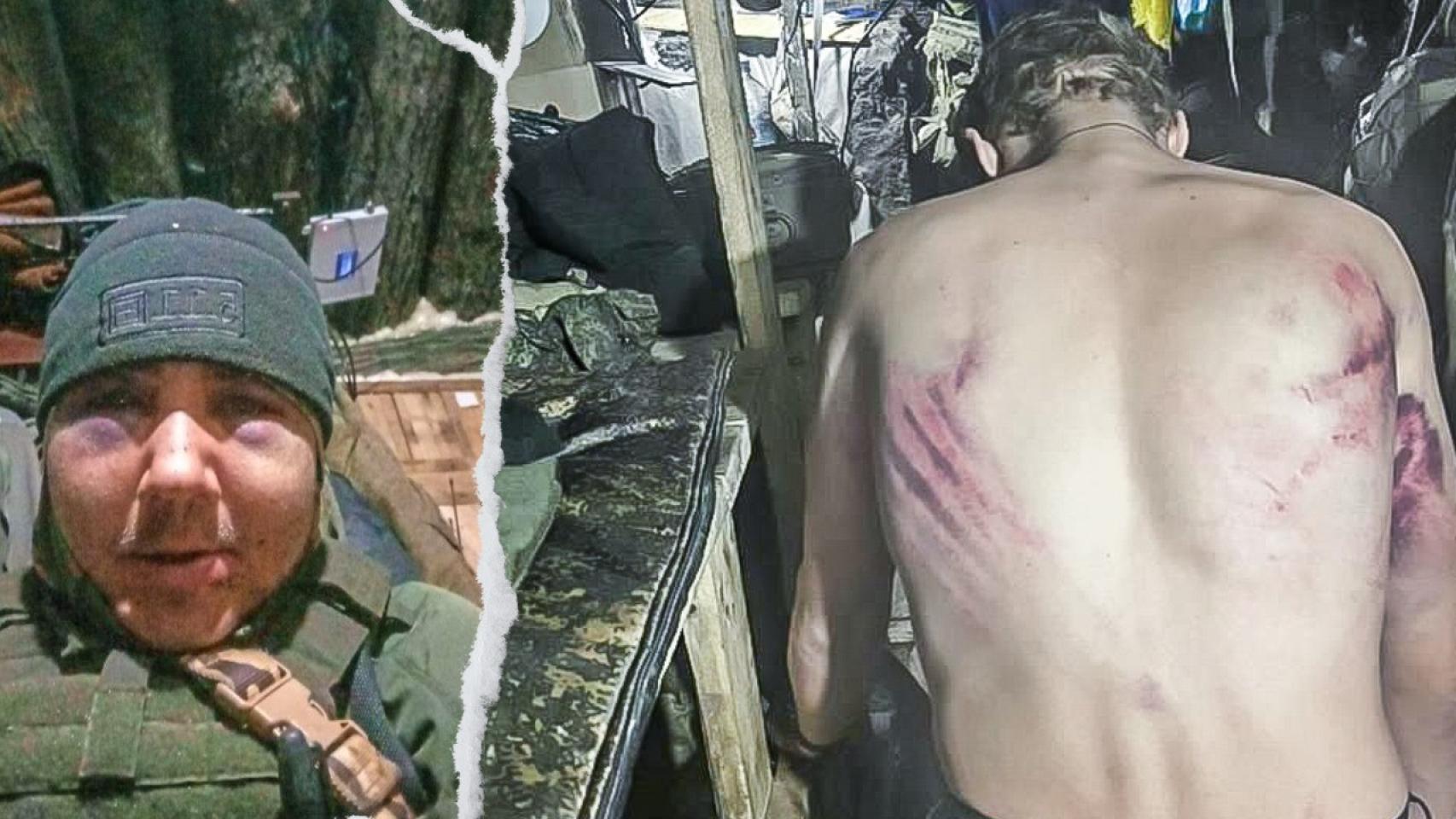 A este combatiente le golpearon sus propios mandos. Su nombre es Meshkov Evgeniy Valerievich, soldado del grupo de asalto“Storm V”, unidad militar 30926. Sirve en Volnovaja.