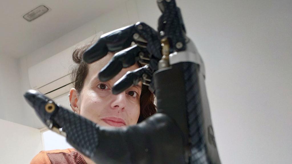 Rut Carpintero, vallisoletana de 43 años que en el pasado mes de abril tuvieron que amputarle las cuatro extremidades